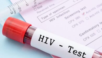 HIV / AIDS Nedir?