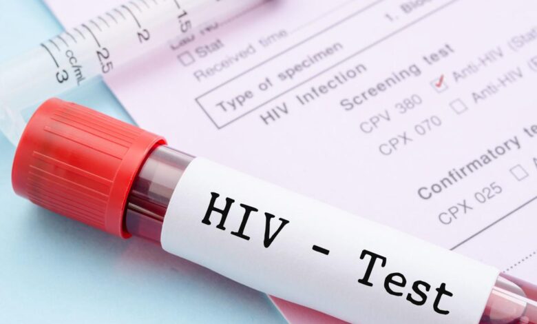 HIV / AIDS Nedir?